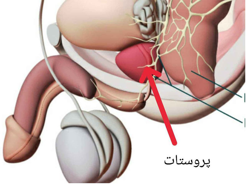 پروستات چیست؟