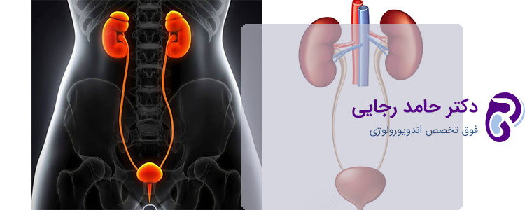 درمان رفلاکس ادراری در مردان