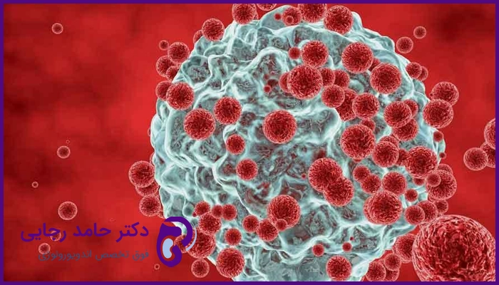 برای تشخیص سرطان پروستان به چه پزشکی باید مراجعه کرد؟