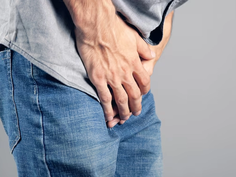 ورم بعد از جراحی واریکوسل