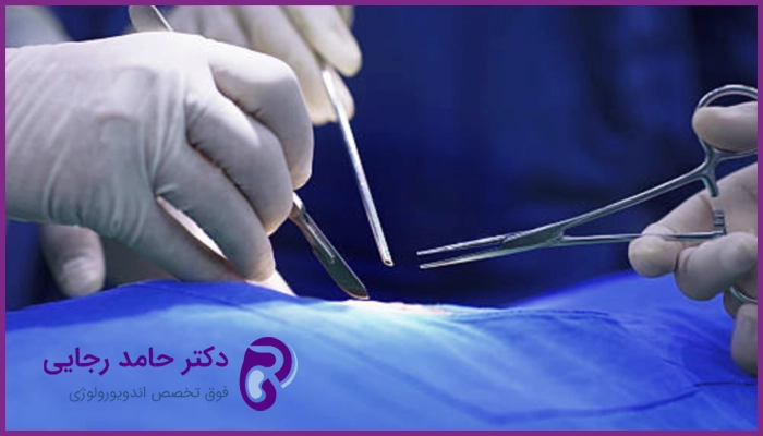 علت انجام جراحی وازکتومی