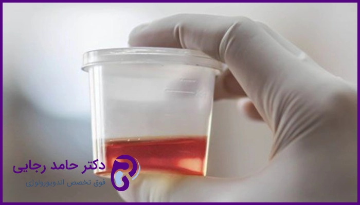 خون در ادرار نشانه چیست