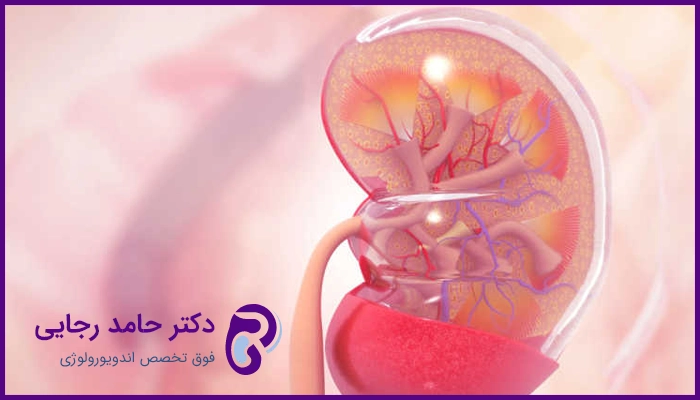درمان نارسایی کلیه