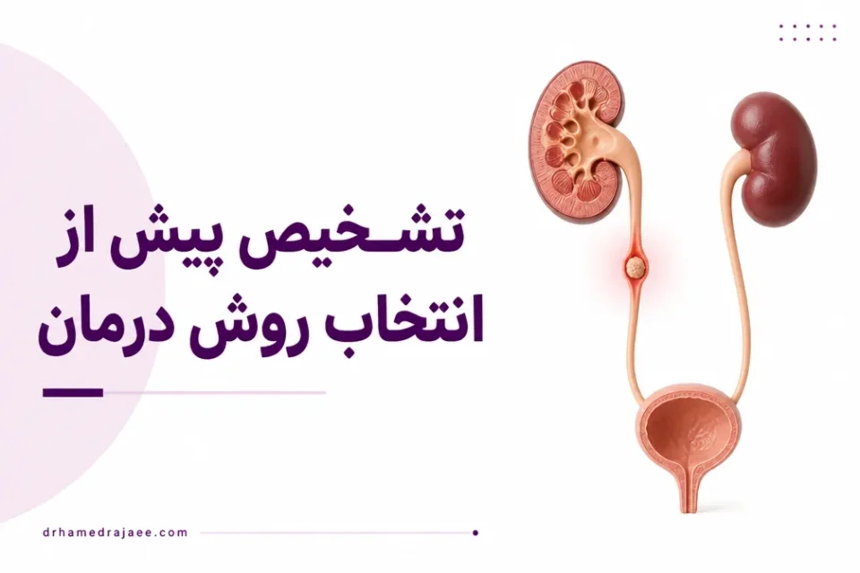 نمای توضیحی درباره تشخیص پیش از انتخاب روش درمان