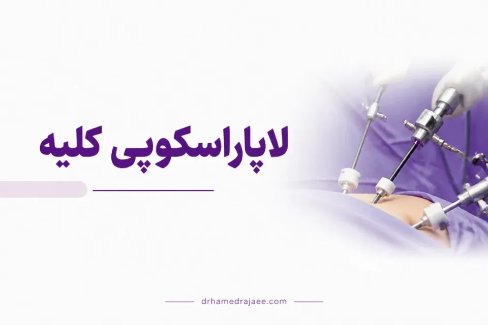 نمای توضیحی درباره برطرف کردن سنگهای بزرگ کلیه یا حالب
